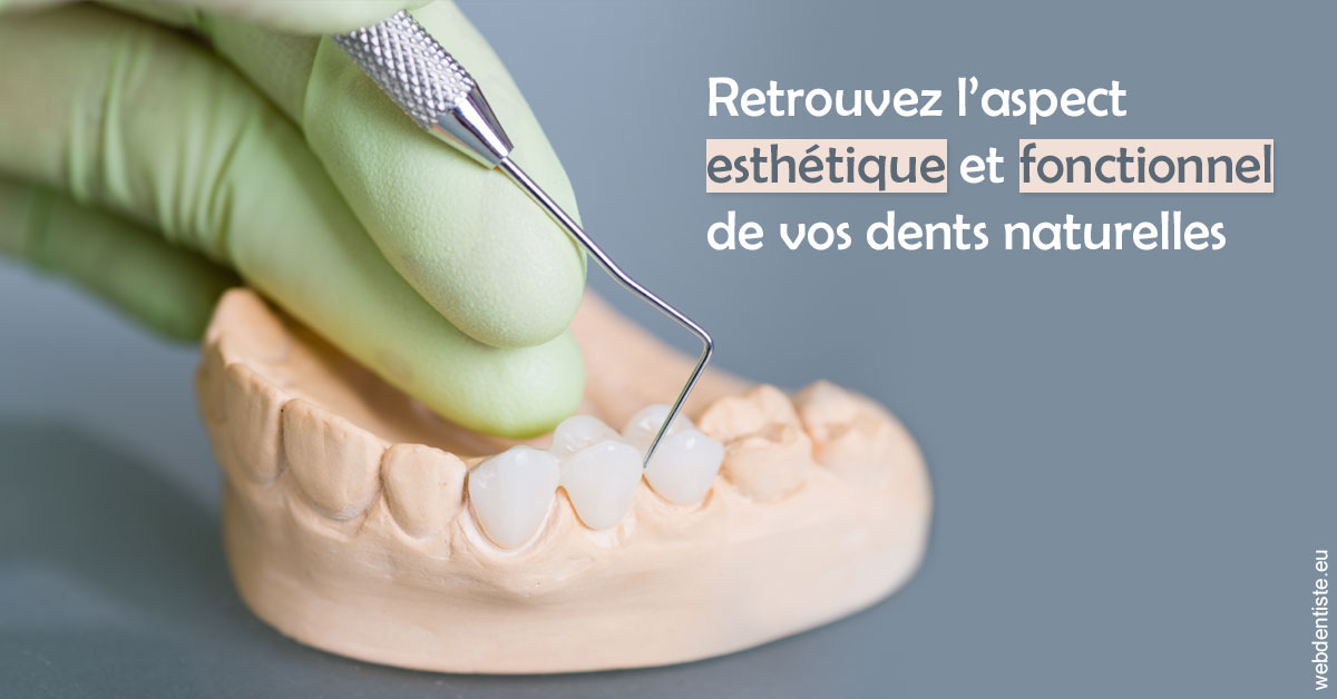 https://www.cabinetdentairemistralmazarin.fr/Restaurations dentaires 1
