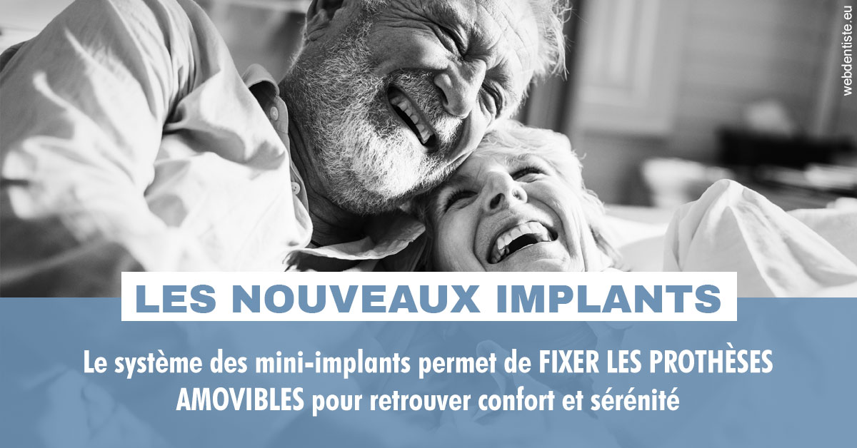 https://www.cabinetdentairemistralmazarin.fr/Les nouveaux implants 2