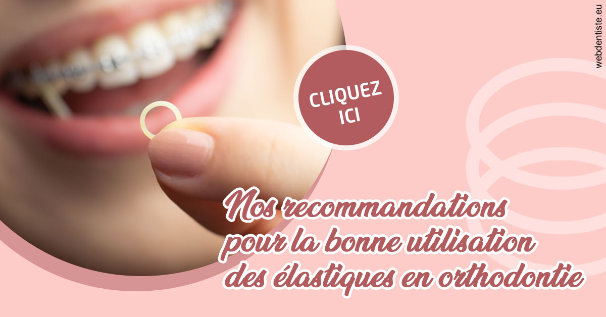 https://www.cabinetdentairemistralmazarin.fr/Elastiques orthodontie 1