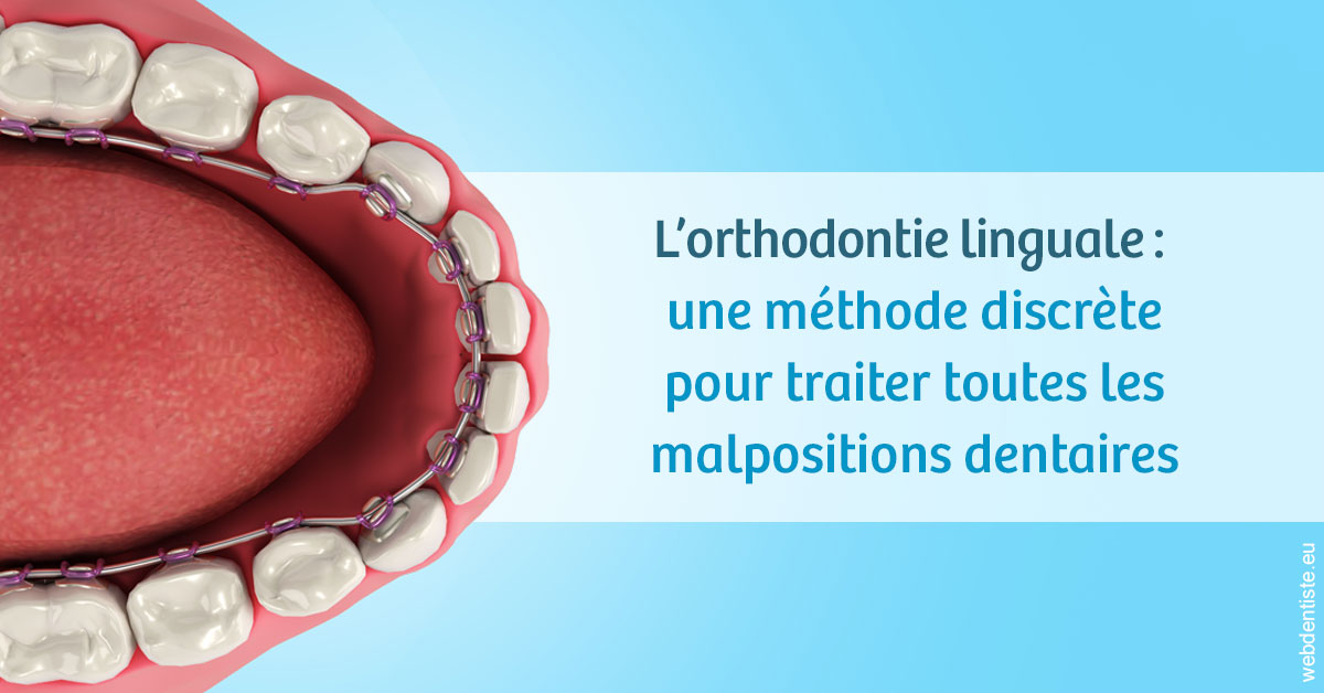 https://www.cabinetdentairemistralmazarin.fr/L'orthodontie linguale 1