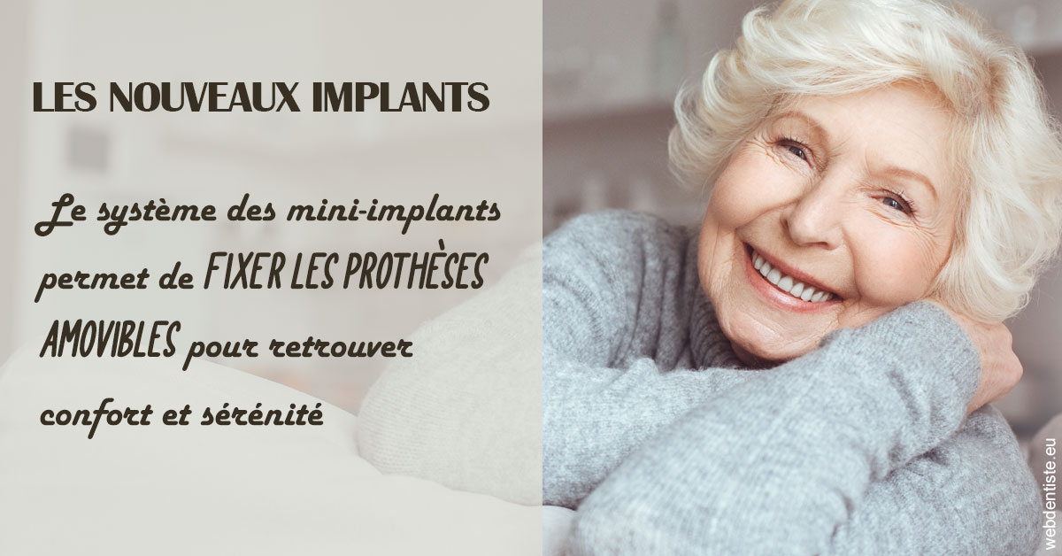 https://www.cabinetdentairemistralmazarin.fr/Les nouveaux implants 1