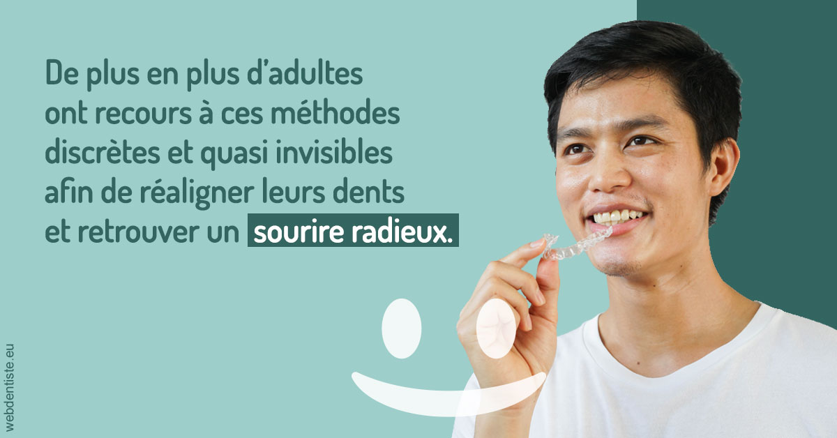 https://www.cabinetdentairemistralmazarin.fr/Gouttières sourire radieux 2