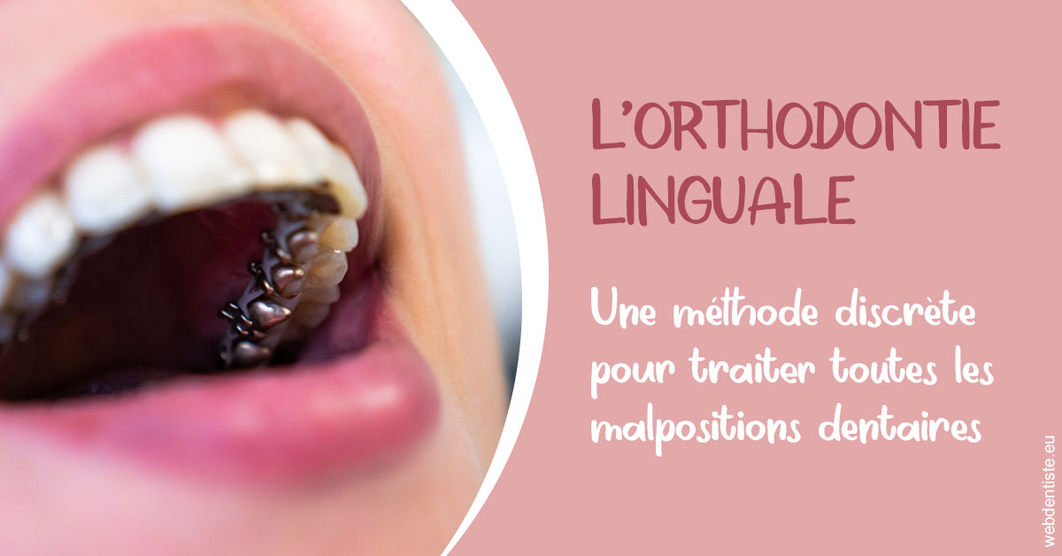 https://www.cabinetdentairemistralmazarin.fr/L'orthodontie linguale 2