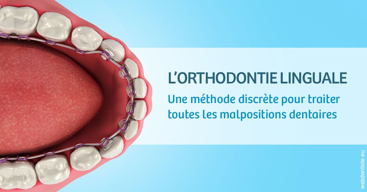 https://www.cabinetdentairemistralmazarin.fr/L'orthodontie linguale 1