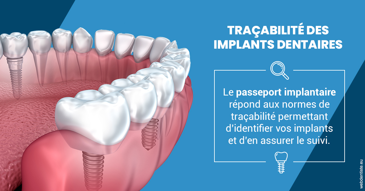 https://www.cabinetdentairemistralmazarin.fr/T2 2023 - Traçabilité des implants 1