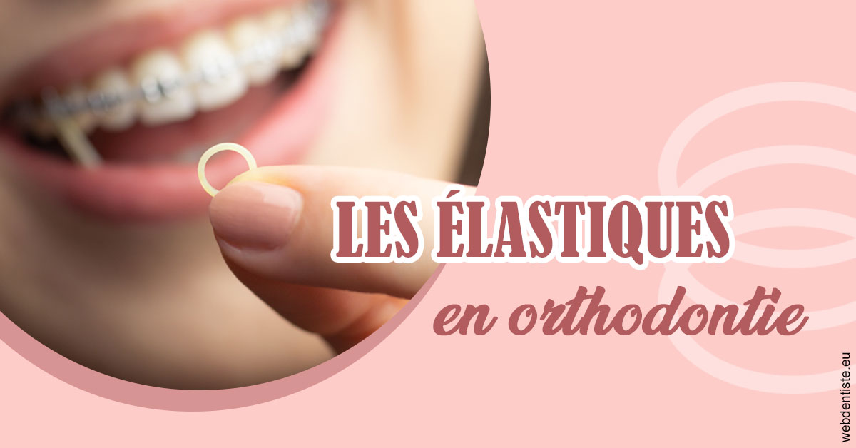 https://www.cabinetdentairemistralmazarin.fr/Elastiques orthodontie 1