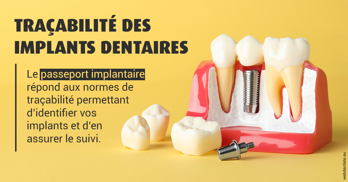 https://www.cabinetdentairemistralmazarin.fr/T2 2023 - Traçabilité des implants 2