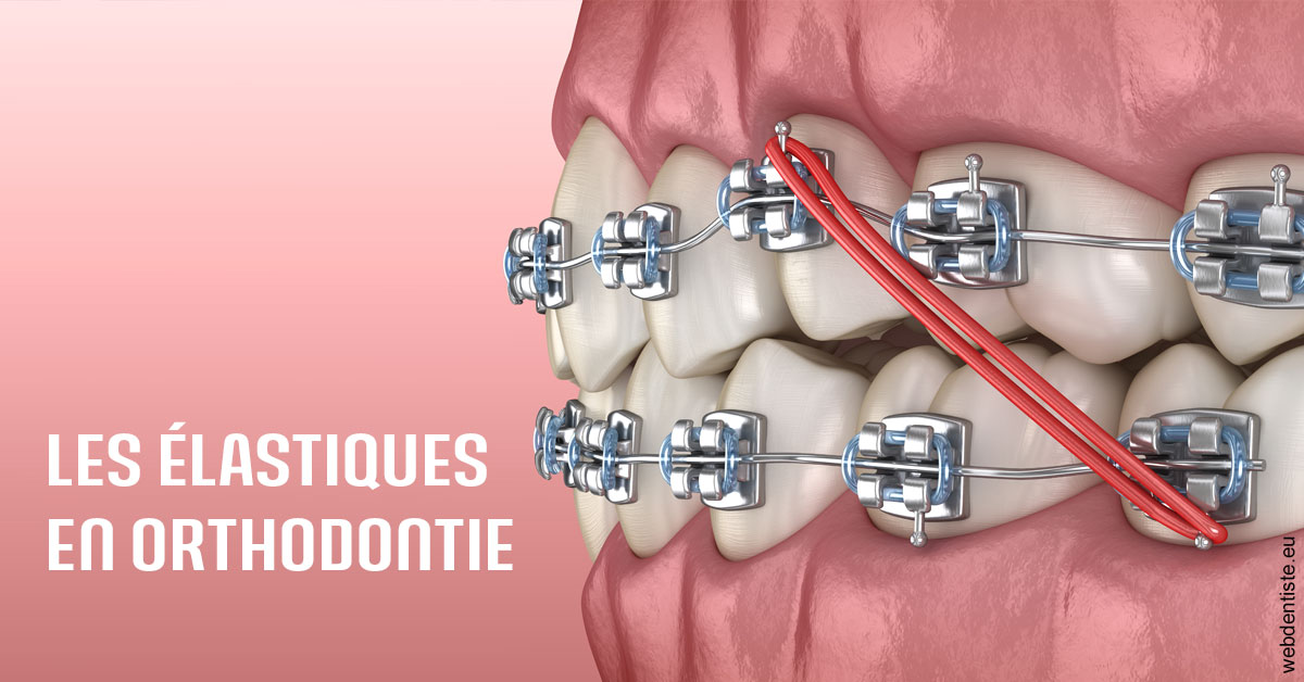 https://www.cabinetdentairemistralmazarin.fr/Elastiques orthodontie 2