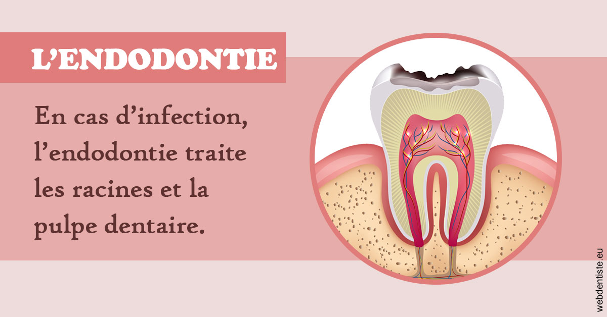 https://www.cabinetdentairemistralmazarin.fr/L'endodontie 2