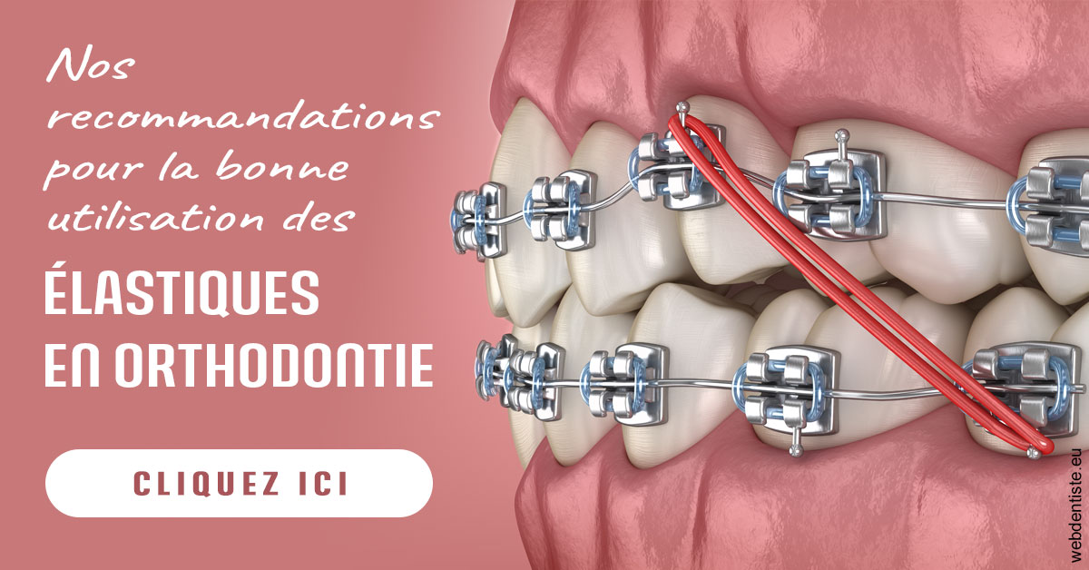https://www.cabinetdentairemistralmazarin.fr/Elastiques orthodontie 2